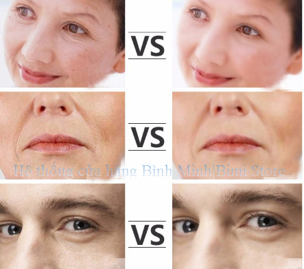 máy làm căng mịn da mini ems swt 150a